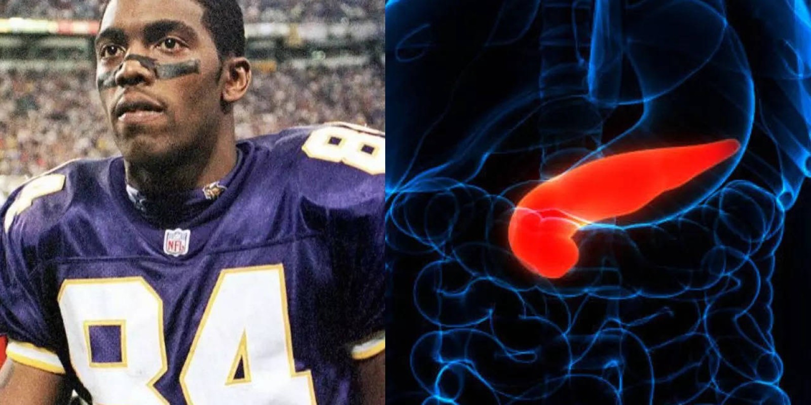 What Is Bile Duct Cancer American NFL Legend Randy Moss Is Battling?