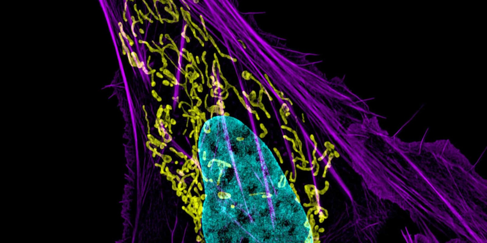 Mitochondrial-targeted gene therapy for treating cancer