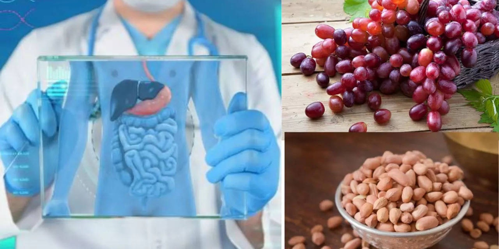 NHS Trial Sets To Identify Foods With “Miraculous” Ingredients That Can Prevent Bowel Cancer