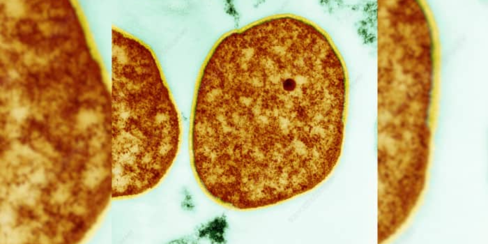 How Ancient Archaea Survive Extreme Heat: Insights From Indian Scientists' Research