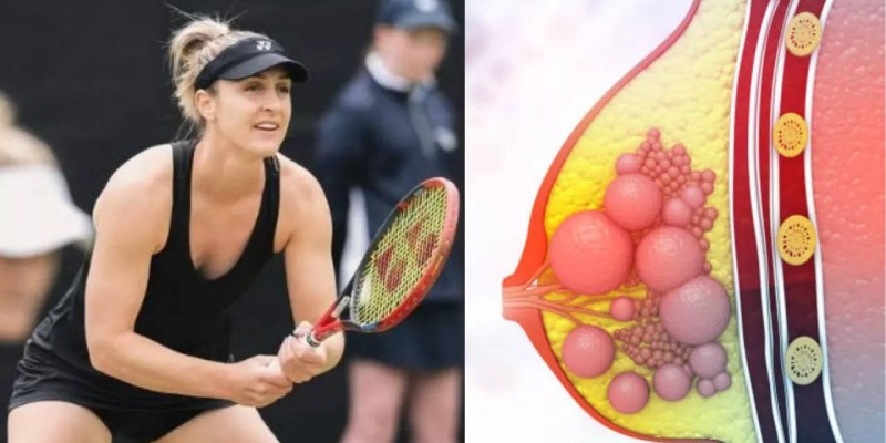 Wimbledon champion Gabriela Dabrowski reveals breast cancer battle during 2024 season.