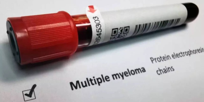 AIIMS develops low-cost cellular therapy for multiple myeloma.