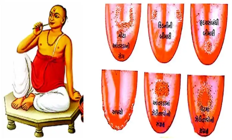 આયુર્વેદિક દિનચર્યા: સ્વસ્થ જીવન માટે  આદર્શ દિનચર્યા