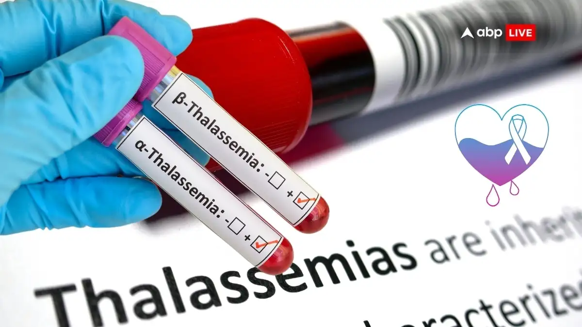 India urged to prioritize genetic screening over horoscope matching to prevent thalassaemia.