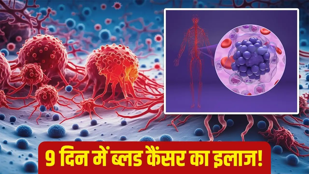 9 दिनों में ब्लड कैंसर का इलाज: ICMR की शोध में बड़ी सफलता