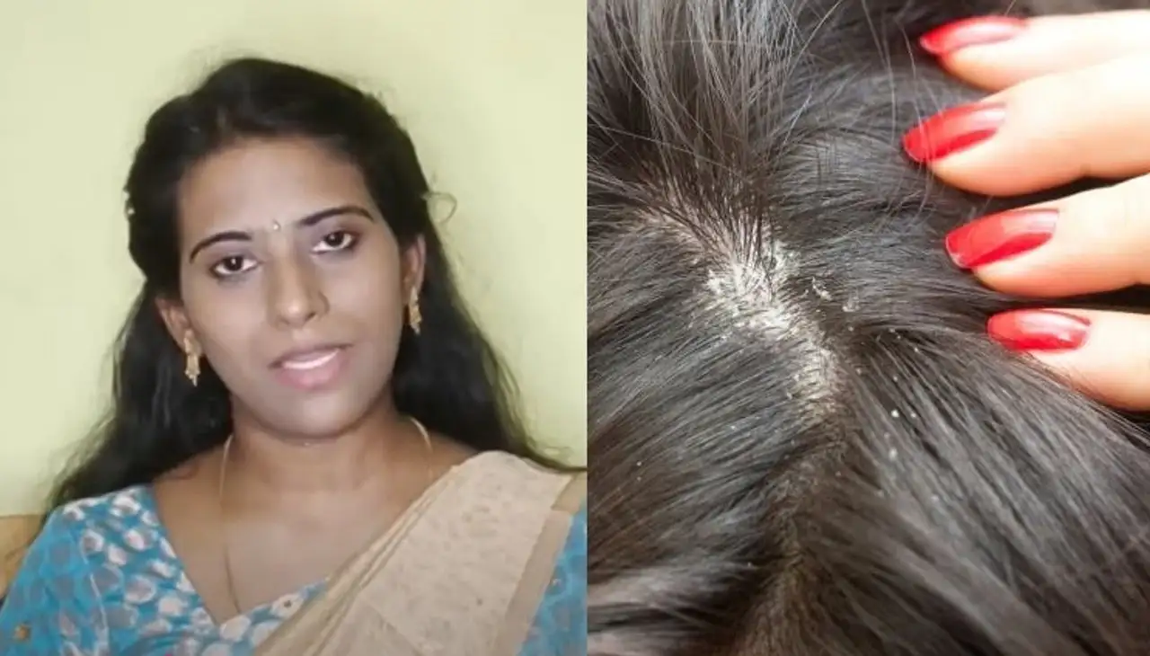 வெந்தயம், தயிர் ஹேர் மாஸ்க்: பொடுகு, முடி உதிர்வு பிரச்னைக்கு தீர்வு