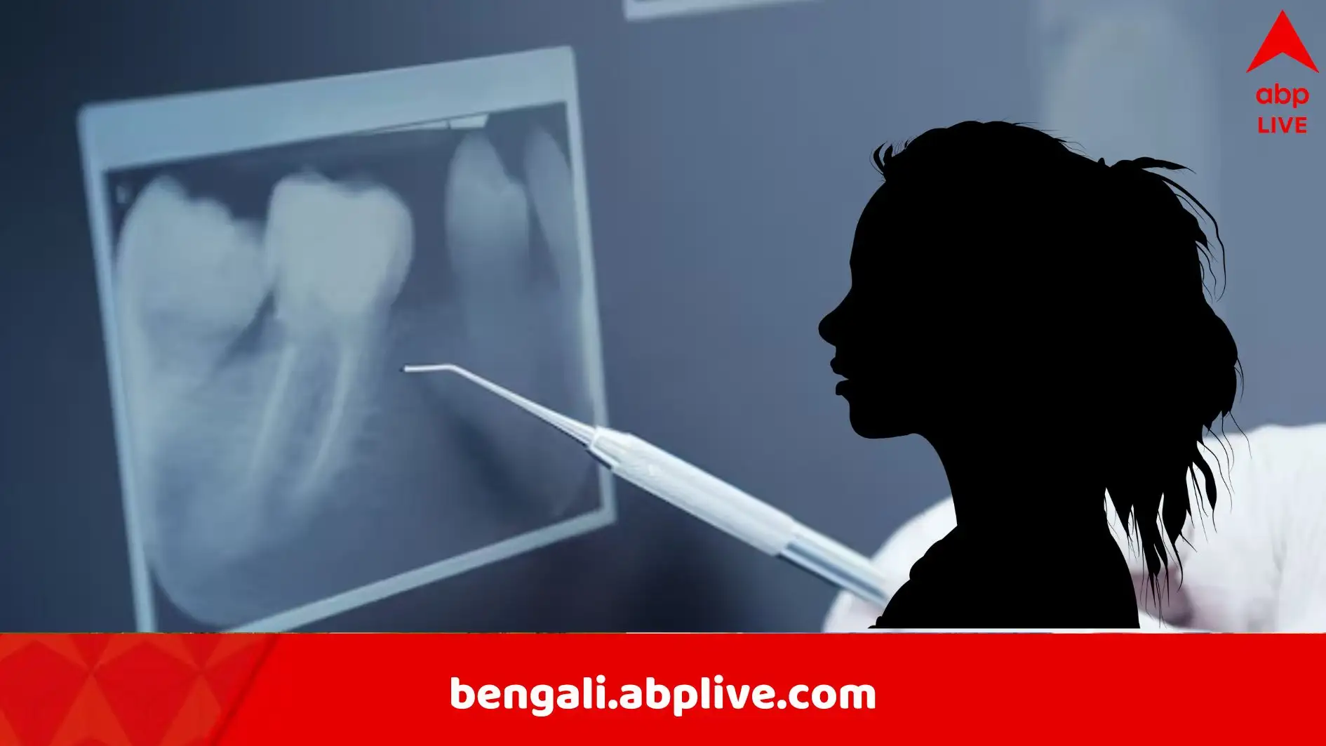 দন্ত চিকিৎসকের ভুল, তরুণীর আত্মহত্যা: আক্কেল দাঁতের অপারেশন ভুল