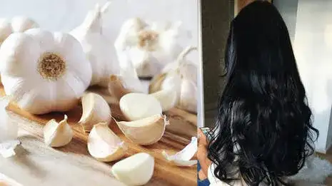 വെളുത്തുള്ളി ഉപയോഗിച്ച് നരച്ച മുടി കറുപ്പാക്കാം: ഒരു ഹോം റെമഡി