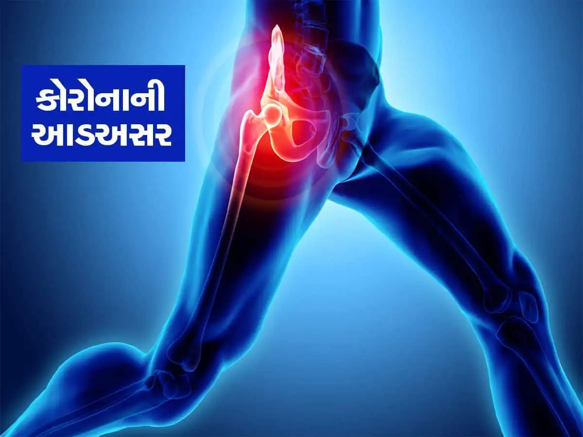 કોરોના બાદ થાપાના ઘસારાના દર્દીઓમાં 15% વધારો