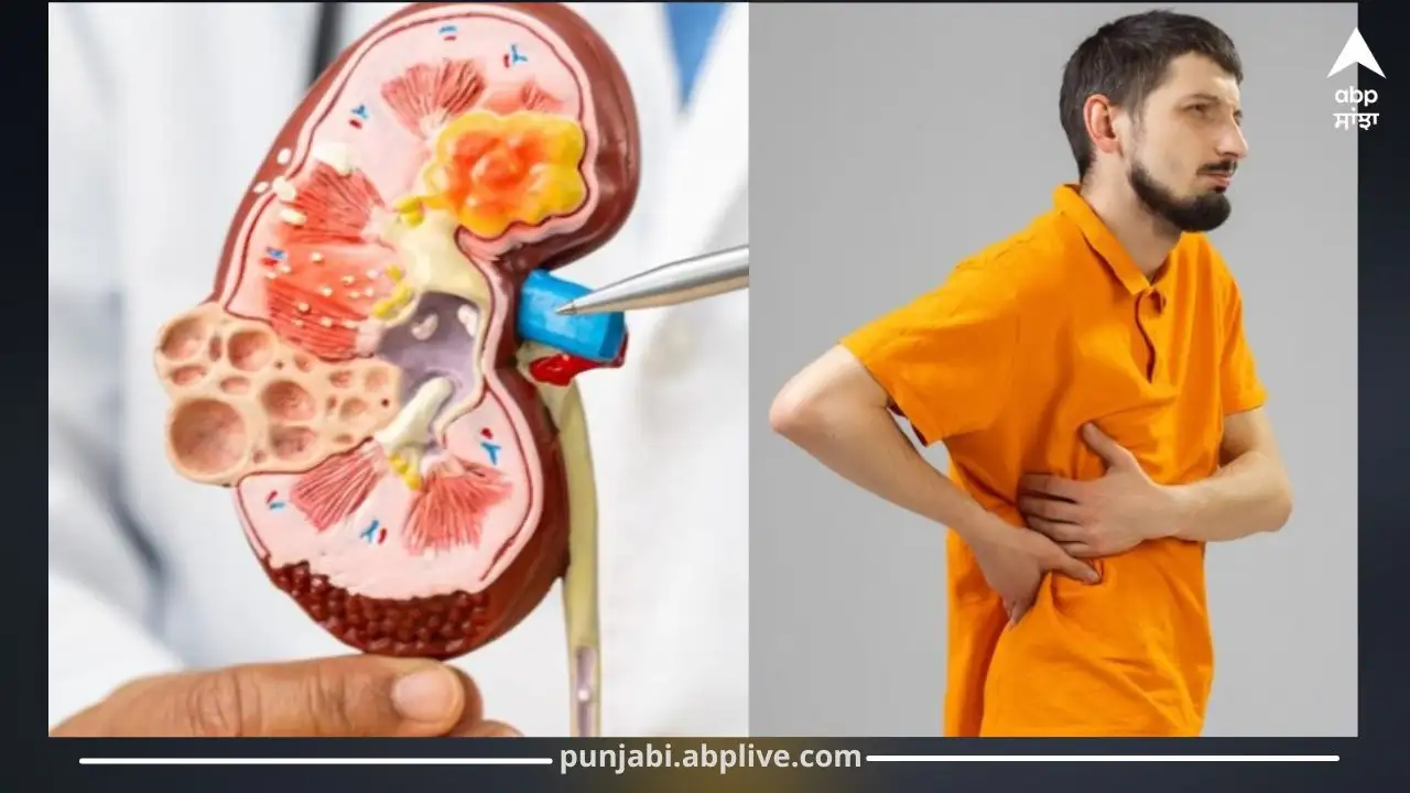 ਗੁਰਦੇ ਦੀ ਅਸਫਲਤਾ ਦੇ ਲੱਛਣ ਅਤੇ ਇਸ ਤੋਂ ਬਚਾਅ ਦੇ ਤਰੀਕੇ।